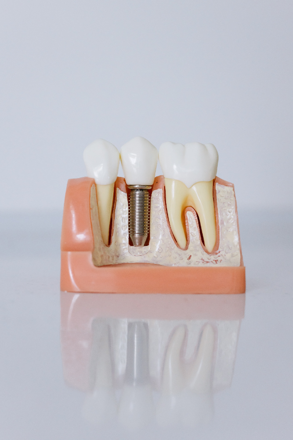 clinica dental miraflores
